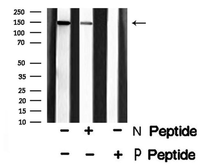 Phospho-PLCG2 (Tyr1197) Antibody in Western Blot (WB)