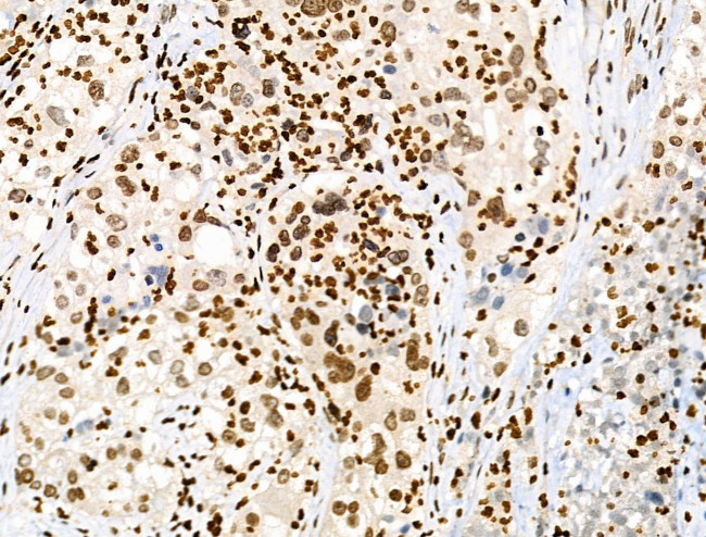 Phospho-PRC1 (Thr470) Antibody in Immunohistochemistry (Paraffin) (IHC (P))