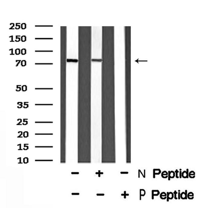 Phospho-PRC1 (Thr470) Antibody in Western Blot (WB)