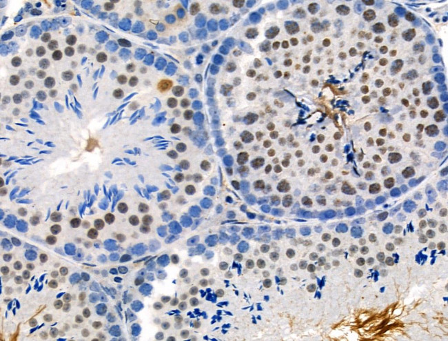 Phospho-PKC alpha (Thr497) Antibody in Immunohistochemistry (Paraffin) (IHC (P))