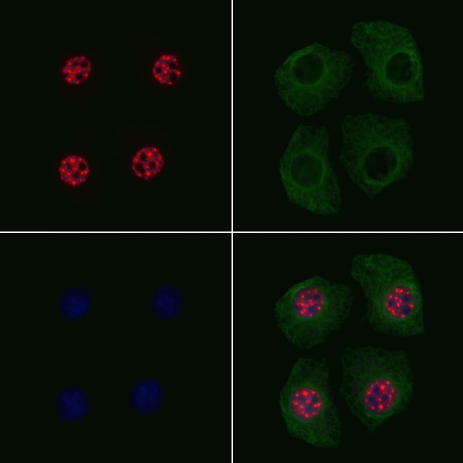 Phospho-p130 (Thr642) Antibody in Immunocytochemistry (ICC/IF)
