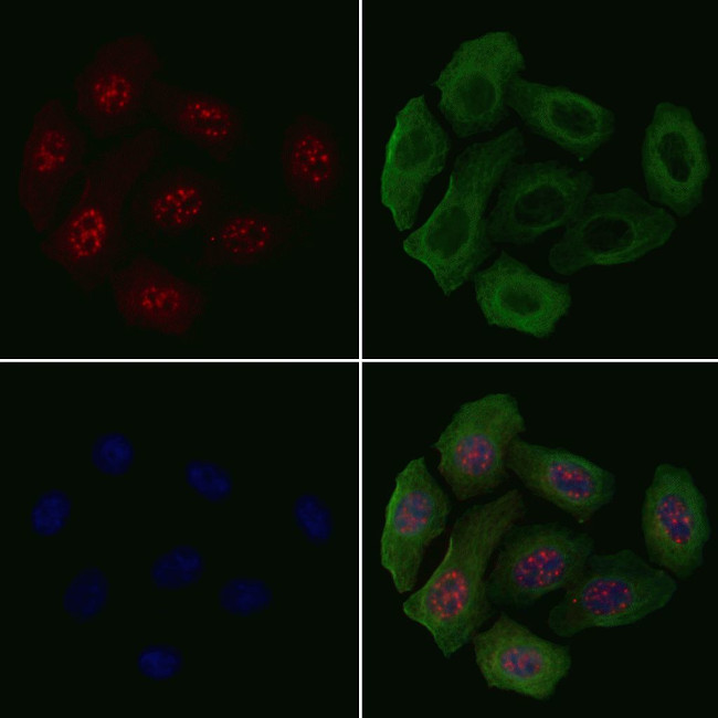 Phospho-p130 (Ser639) Antibody in Immunocytochemistry (ICC/IF)