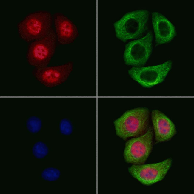 Phospho-Androgen Receptor (Ser792) Antibody in Immunocytochemistry (ICC/IF)