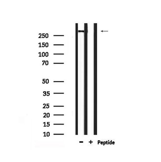 Phospho-ATM (Ser1987) Antibody in Western Blot (WB)