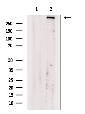 Phospho-ATM (Ser794) Antibody in Western Blot (WB)
