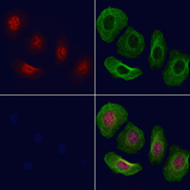 Phospho-Chk2 (Ser379) Antibody in Immunocytochemistry (ICC/IF)