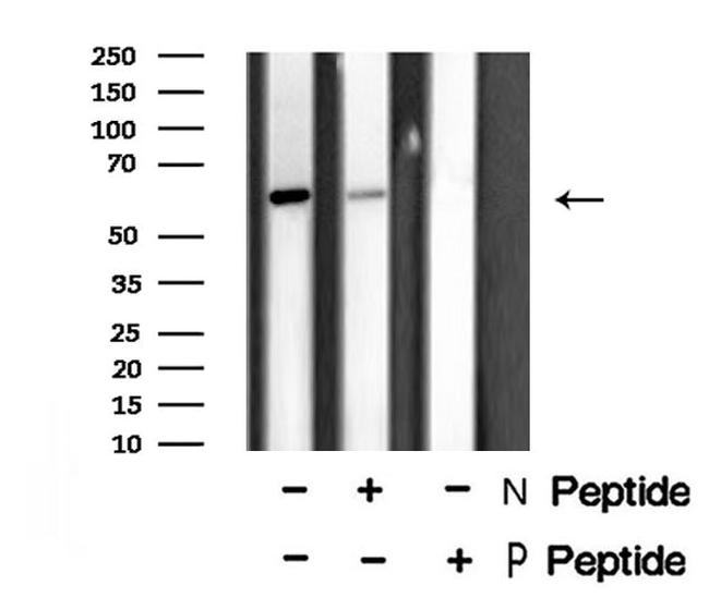 Phospho-CRMP1 (Thr509) Antibody in Western Blot (WB)