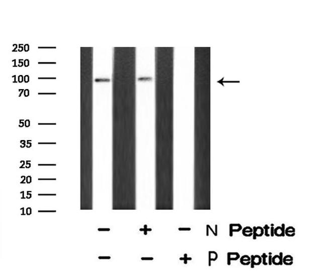 Phospho-CSF1R (Tyr921) Antibody in Western Blot (WB)