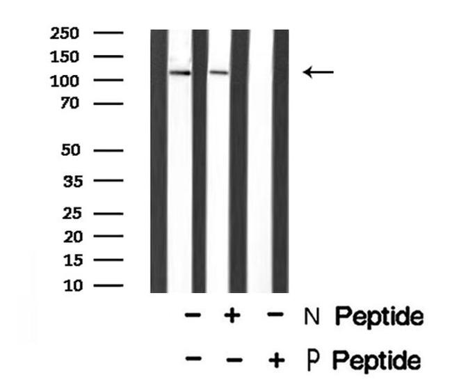 Phospho-DDR1 (Tyr796) Antibody in Western Blot (WB)