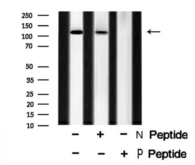 Phospho-EphA5 (Tyr650) Antibody in Western Blot (WB)