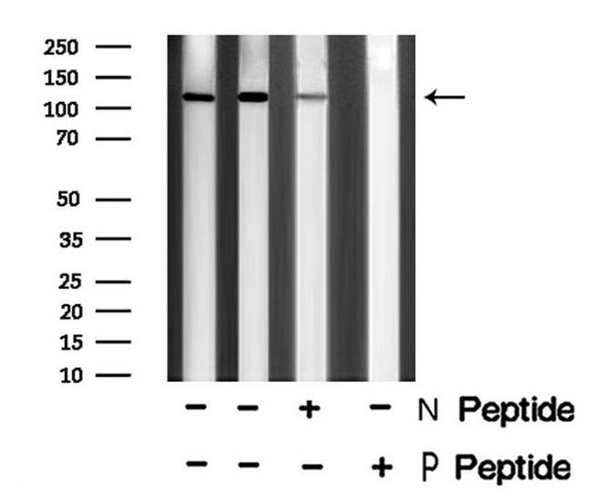 Phospho-EphA6 (Tyr978) Antibody in Western Blot (WB)