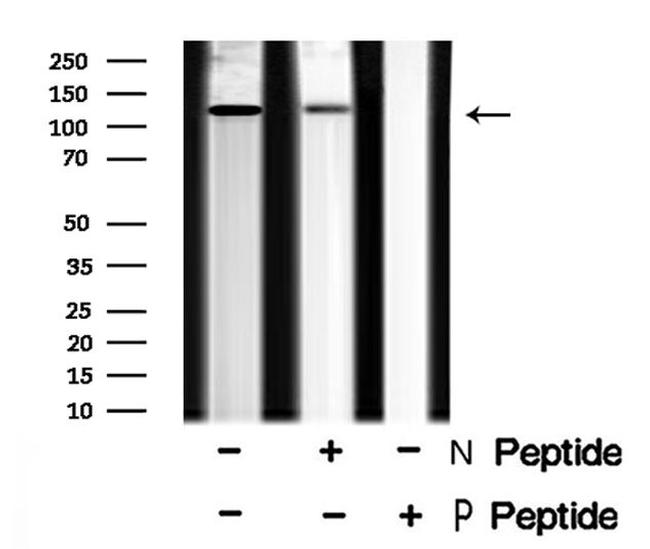 Phospho-EphB1/EphB2 (Tyr778, Tyr780) Antibody in Western Blot (WB)
