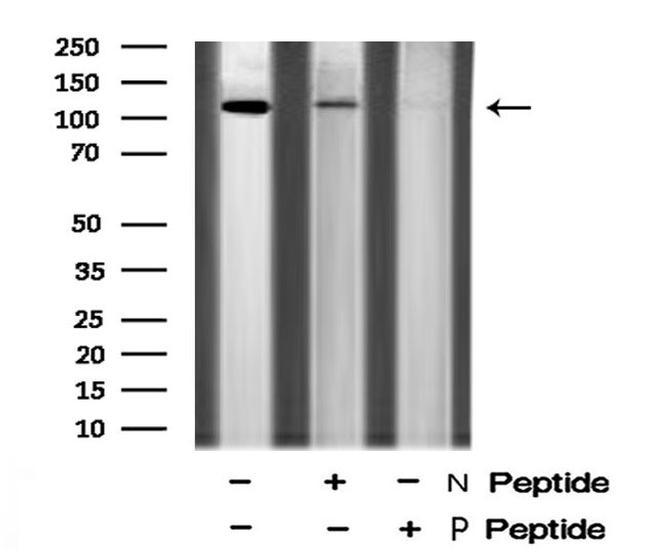 Phospho-EphB3 (Tyr608) Antibody in Western Blot (WB)
