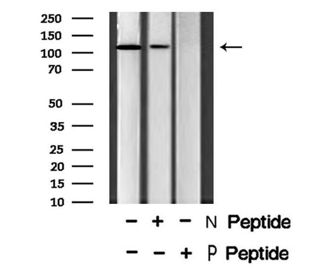 Phospho-EphB4 (Tyr987) Antibody in Western Blot (WB)