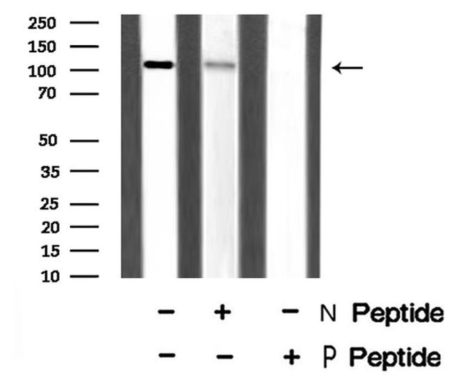 Phospho-EphB6 (Tyr651) Antibody in Western Blot (WB)