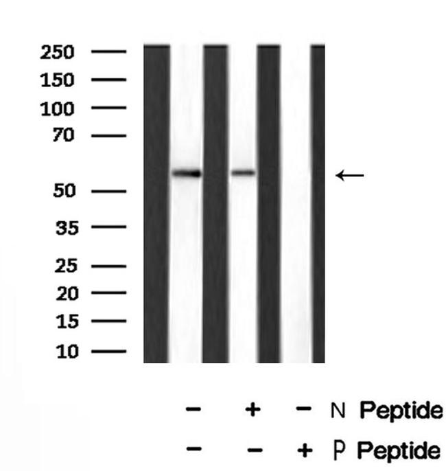 Phospho-EpoR (Tyr426) Antibody in Western Blot (WB)