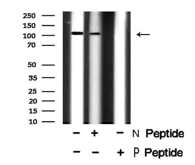 Phospho-MER/TYRO3 (Tyr753, Tyr685) Antibody in Western Blot (WB)
