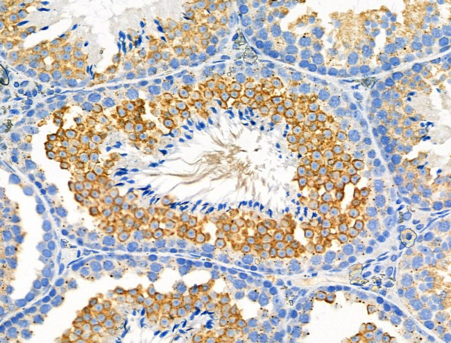 Phospho-Met (Tyr1313) Antibody in Immunohistochemistry (Paraffin) (IHC (P))