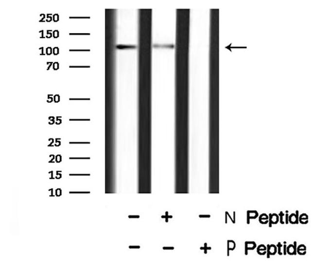 Phospho-MYPT1/MYPT2 (Ser668, Ser618) Antibody in Western Blot (WB)