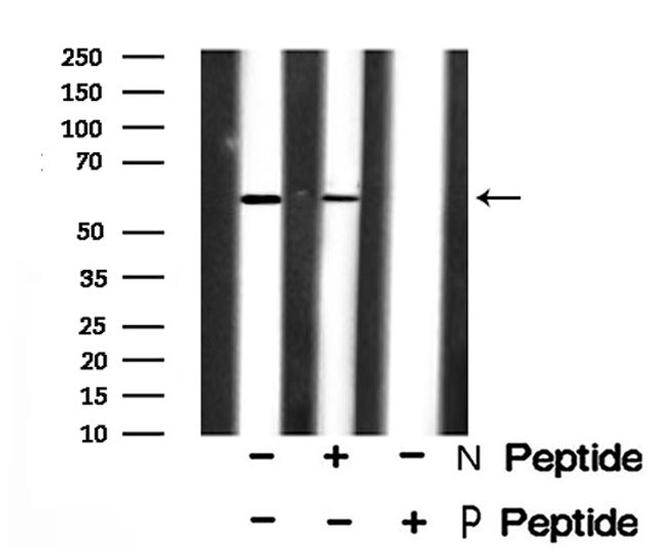 Phospho-SMAD3 (Ser423) Antibody in Western Blot (WB)