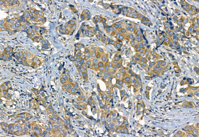 Phospho-TGFBR1 (Thr204) Antibody in Immunohistochemistry (Paraffin) (IHC (P))