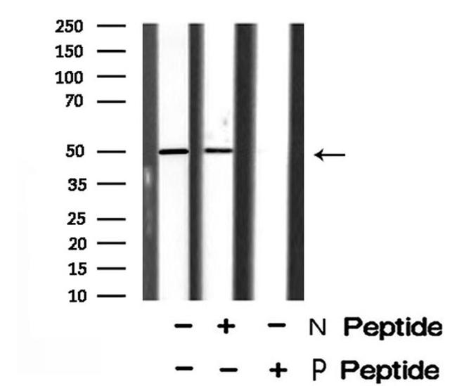 Phospho-AP2M1 (Thr156) Antibody in Western Blot (WB)
