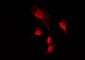 Phospho-Amyloid Precursor Protein (Thr729) Antibody in Immunocytochemistry (ICC/IF)
