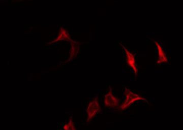 Phospho-CD19 (Tyr500) Antibody in Immunocytochemistry (ICC/IF)