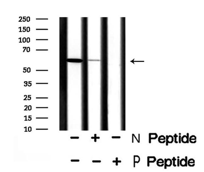 Phospho-TPL2 (Ser400) Antibody in Western Blot (WB)