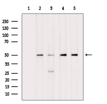 Phospho-eIF5 (Ser389, Ser390) Antibody in Western Blot (WB)