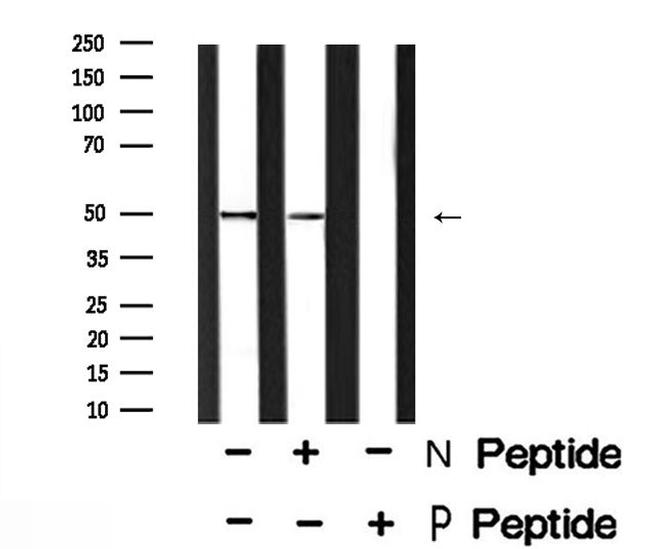Phospho-GFAP (Ser13) Antibody in Western Blot (WB)