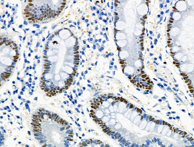 Phospho-MCM2 (Ser27) Antibody in Immunohistochemistry (Paraffin) (IHC (P))