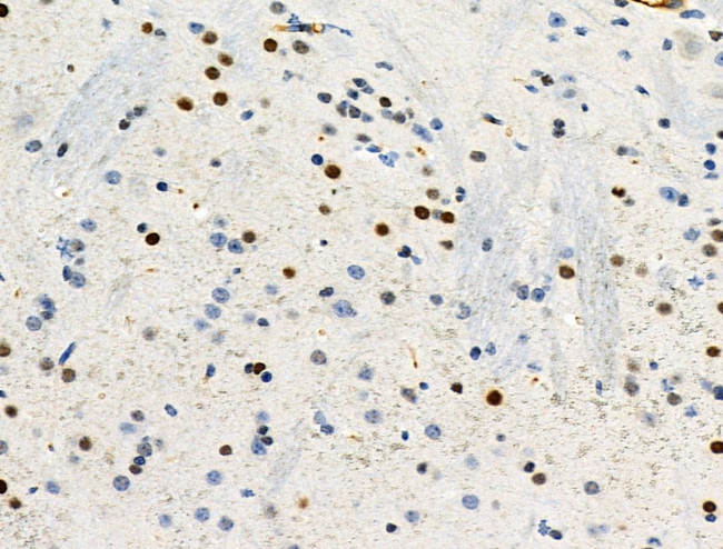 Phospho-NPM1 (Ser4) Antibody in Immunohistochemistry (Paraffin) (IHC (P))