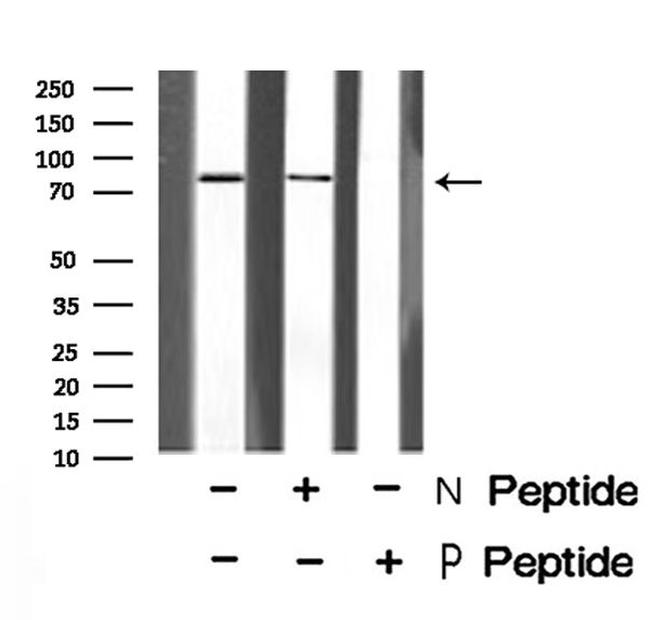Phospho-RSK2 (Tyr529) Antibody in Western Blot (WB)