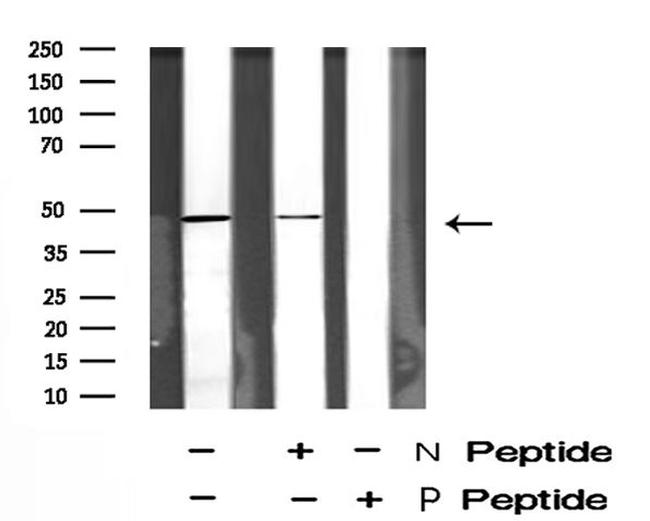 Phospho-STYK1 (Tyr327) Antibody in Western Blot (WB)