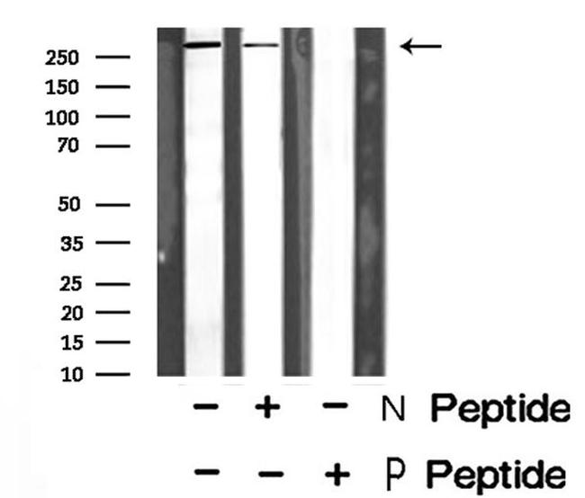 Phospho-Talin 1 (Ser425) Antibody in Western Blot (WB)