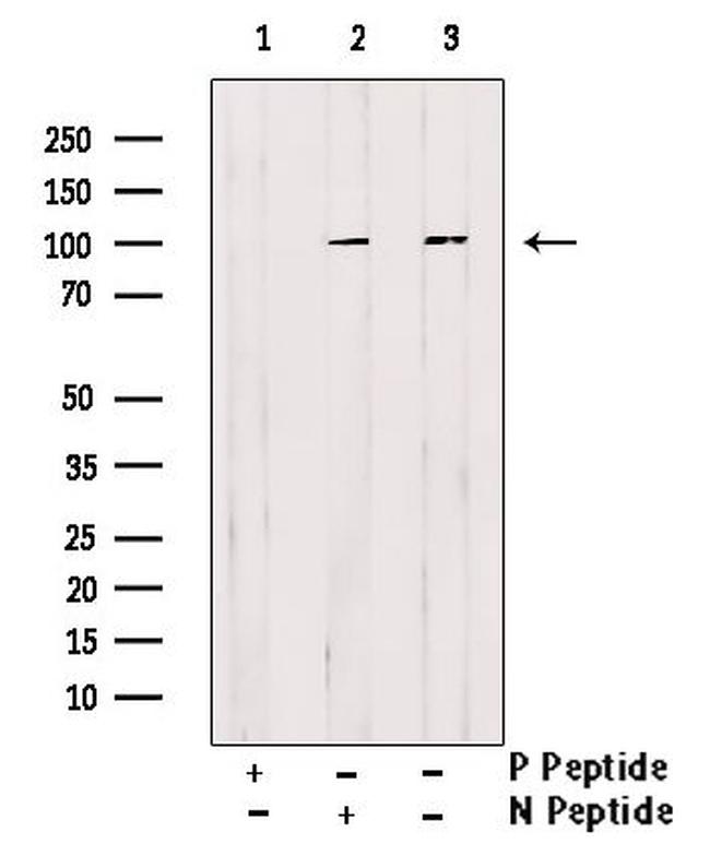 Phospho-Axl (Tyr698) Antibody in Western Blot (WB)