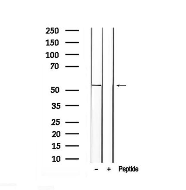 Phospho-Fumarase (Thr90) Antibody in Western Blot (WB)