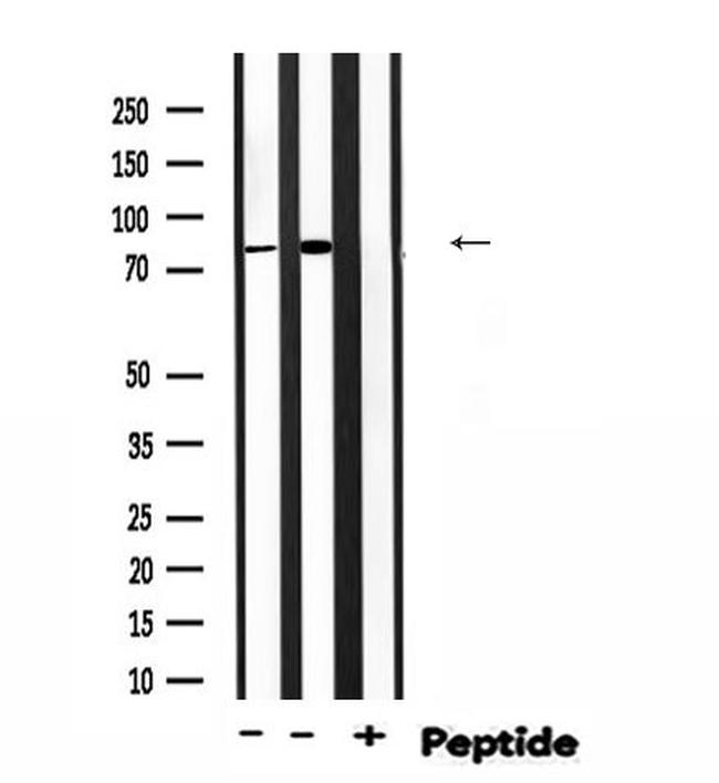 Phospho-EZH2 (Thr369) Antibody in Western Blot (WB)