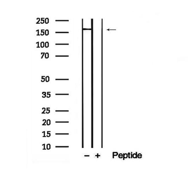 Phospho-DEPDC5 (Thr1531) Antibody in Western Blot (WB)