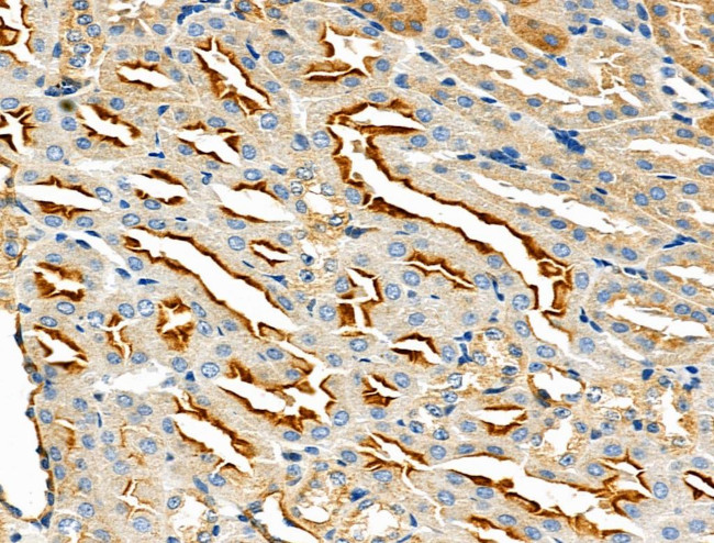 Phospho-PRPS1 (Ser180) Antibody in Immunohistochemistry (Paraffin) (IHC (P))