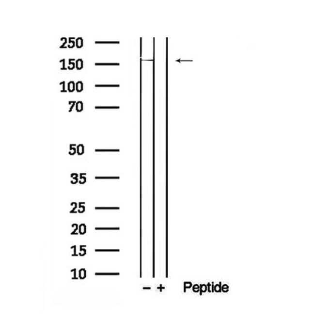 Phospho-DEPDC5 (Ser1002) Antibody in Western Blot (WB)