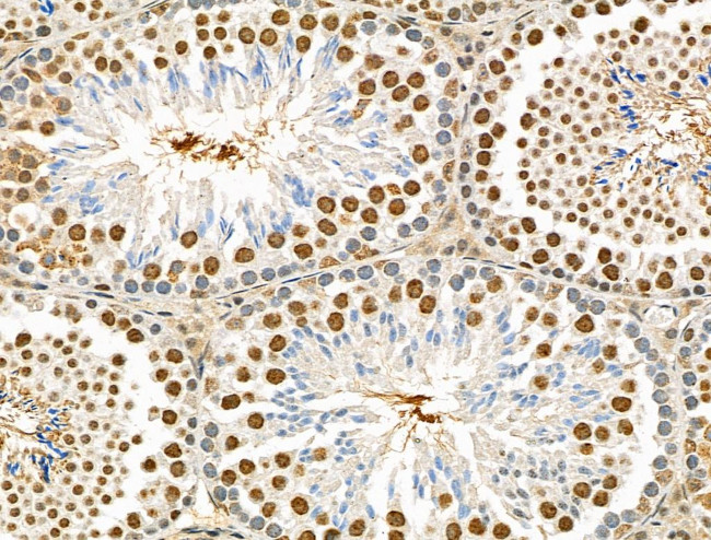 Phospho-BCLAF1 (Ser512) Antibody in Immunohistochemistry (Paraffin) (IHC (P))