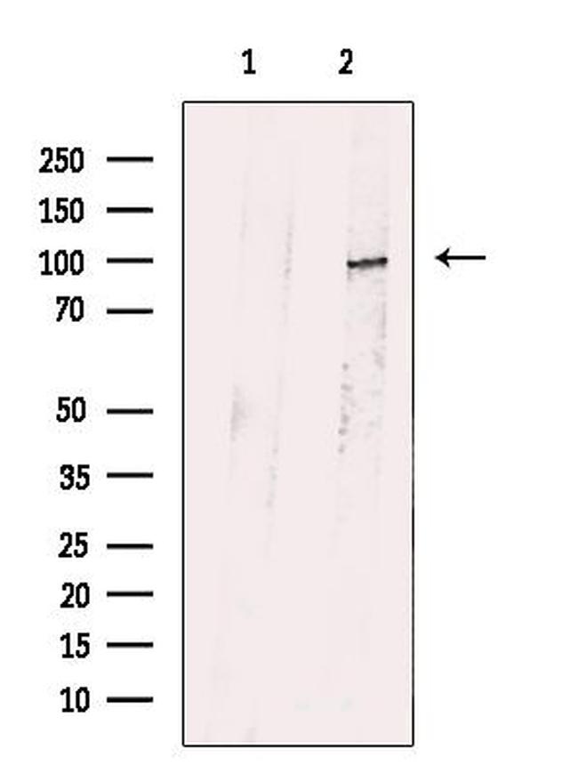 PKD2 Antibody in Western Blot (WB)