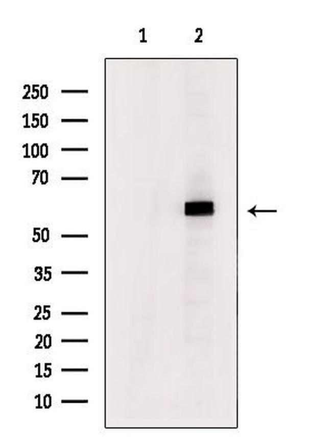 DYRK2/DYRK4 Antibody in Western Blot (WB)