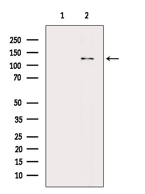 HIPK1/HIPK2/HIPK3 Antibody in Western Blot (WB)