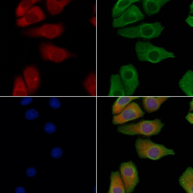 EphB1/EphB3/EphB4 Antibody in Immunocytochemistry (ICC/IF)