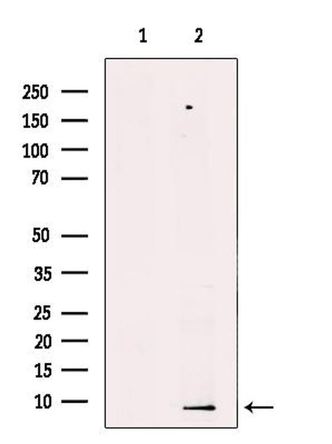 PDE6 gamma Antibody in Western Blot (WB)