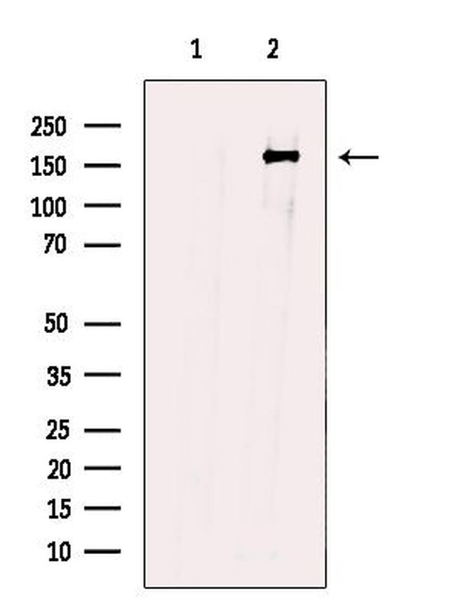 LTK/ALK Antibody in Western Blot (WB)