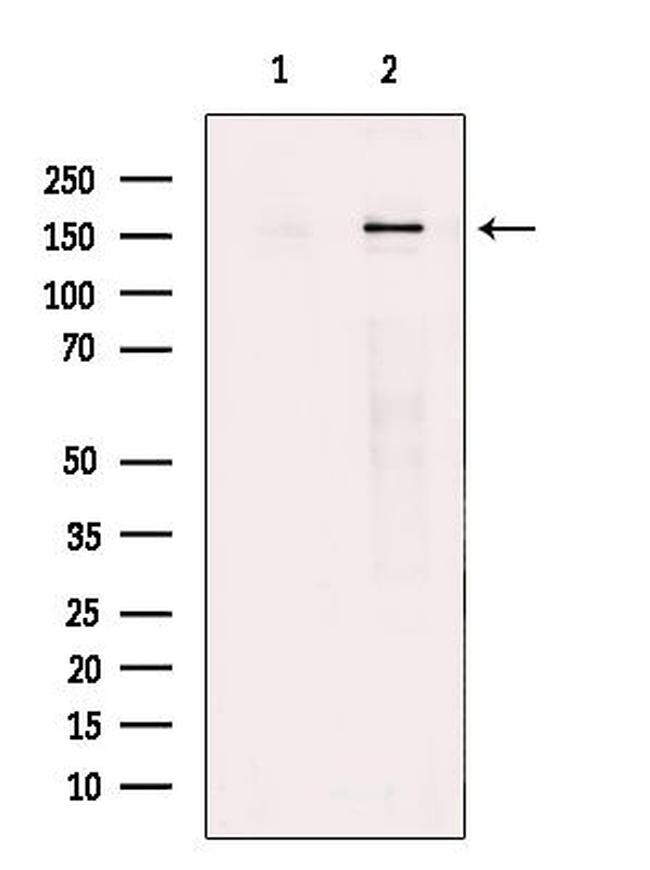 TOPBP1 Antibody in Western Blot (WB)